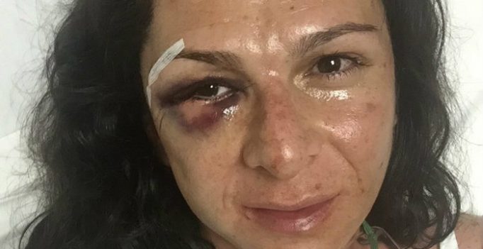 Confirma Policía Federal que Ana Guevara fue golpeada por cuatro hombres